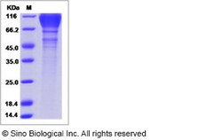 Sino Biological HIV-1 (group M, subtype B, strain SHIV-89.6P) gp120 Protein