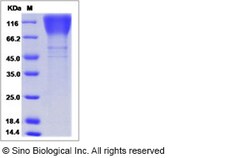 Sino Biological HIV-1 (group M, subtype A, isolate 92RW020) Envelope glycoprotein