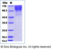 Sino Biological Human immunodeficiency virus 1 (HIV-1) (group M, subtype