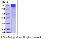Sino Biological Simian immunodeficiency virus (SIV) (isolate F236) envelope