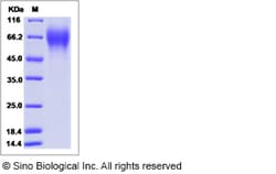 Sino Biological Influenza B (B/Brisbane/3/2007) Hemagglutinin / HA1 Protein