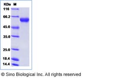 Sino Biological Influenza A H10N7 (A/blue-winged teal/Louisiana/Sg-00073/2007)