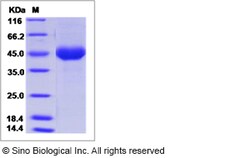 Sino Biological Influenza A H10N7 (A/blue-winged teal/Louisiana/Sg-00073/2007)