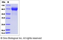 Sino Biological Influenza A H3N2 (A/New York/55/2004) Hemagglutinin / HA1