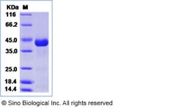 Sino Biological Chikungunya virus (CHIKV) (strain SL-CK1) E2 / Envelope