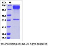 Sino Biological Ebola virus EBOV (subtype Zaire, strain H.sapiens-wt/GIN/2014/Kissidougou-C15)