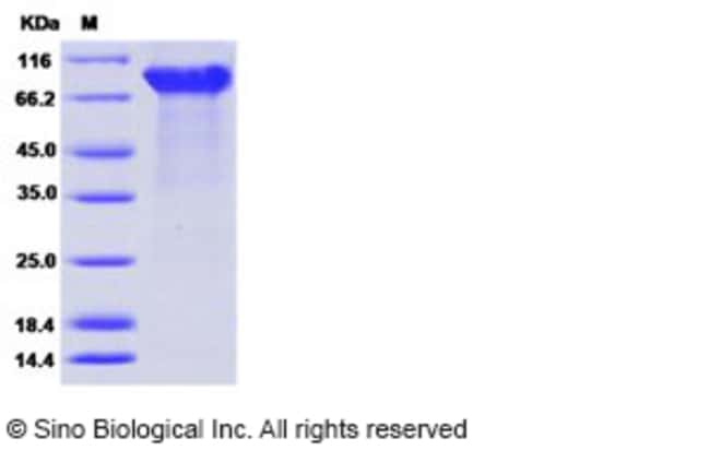 Sino Biologicalebola Virus Ebov Subtype Zaire Strain H Sapiens Wt Gin 2014 Kissidougou C15 Fisher Scientific<script async src=