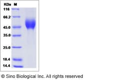 Sino Biological Ebola virus EBOV (subtype Zaire, strain H.sapiens-wt/GIN/2014/Makona-Kissidougou-C15)