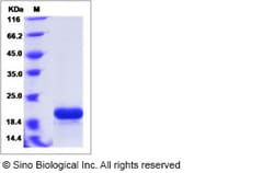 Sino Biological Ebola virus EBOV (subtype Zaire, strain H.sapiens-wt/GIN/2014/Kissidougou-C15)