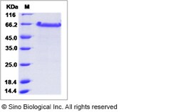 Sino Biological Ebola virus EBOV (Sudan ebolavirus, strain Gulu) Nucleoprotein