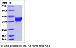 Sino Biological Ebola virus EBOV (subtype Zaire, strain H.sapiens-wt/GIN/2014/Kissidougou-C15)