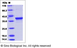Sino Biological Ebola virus EBOV (subtype Bundibugyo, strain Uganda 2007)