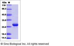 Sino Biological Ebola virus EBOV (subtype Zaire, strain H.sapiens-wt/GIN/2014/Kissidougou-C15)