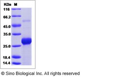 Sino Biological Ebola virus EBOV (subtype Bundibugyo, strain Uganda 2007)