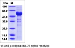 Sino Biological Dromedary camel coronavirus (DcCoV)(strain HKU23-368F)
