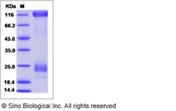 Sino Biological Ebola virus EBOV (subtype Zaire, strain Ebola virus H.sapiens-wt/SLE/2014/ManoRiver-G3686.1)