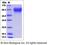 Sino Biological Influenza B (B/Wisconsin/01/2012) Hemagglutinin / HA1 Protein