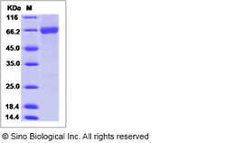 Sino Biological Influenza B (B/Utah/02/2012) Hemagglutinin / HA Protein