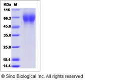 Sino Biological Influenza B (B/Utah/02/2012) Hemagglutinin / HA1 Protein