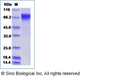 Sino Biological Influenza A H1N1 (A/Albany/12/1951) Hemagglutinin / HA