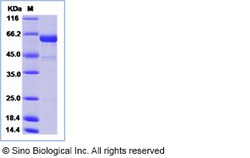 Sino Biological Influenza A H5N6 (A/duck/Jiangxi/95/2014) Hemagglutinin
