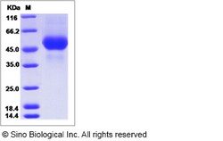 Sino Biological Influenza A H5N6 (A/duck/Jiangxi/95/2014) Hemagglutinin