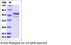 Sino Biological Dengue virus (DENV) (type 2, strain New Guinea C/PUO-218