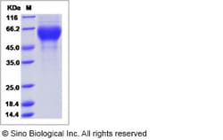 Sino Biological Influenza A H3N2 (A/Johannesburg/33/1994) Hemagglutinin