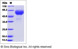 Sino Biological Influenza A H3N2 (A/England/42/1972) Hemagglutinin / HA1