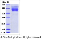 Sino Biological Influenza A H3N2 (A/Guizhou/54/1989) Hemagglutinin / HA1