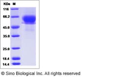 Sino Biological Influenza A H3N2 (A/Nanchang/933/1995) Hemagglutinin /