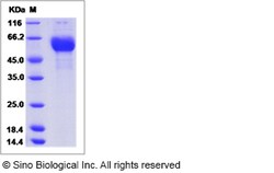 Sino Biological Influenza A H3N2 (A/Netherlands/178/1995(RG145K)) Hemagglutinin