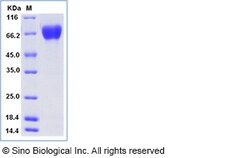 Sino Biological Influenza A H3N2 (A/Philippines/472/2002) Hemagglutinin