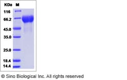 Sino Biological Influenza A H3N2 (A/Hanoi/EL134/2008) Hemagglutinin / HA1