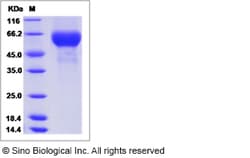Sino Biological Influenza A H3N2 (A/Hanoi/EL201/2009) Hemagglutinin / HA1