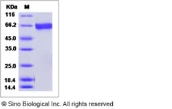 Sino Biological Influenza A H3N2 (A/Missouri/09/2014) Hemagglutinin / HA