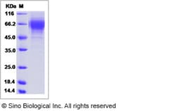 Sino Biological Influenza A H3N2 (A/Missouri/09/2014) Hemagglutinin / HA1
