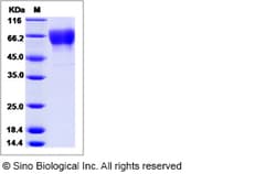 Sino Biological Influenza A H3N2 (A/Switzerland/9715293/2013) Hemagglutinin