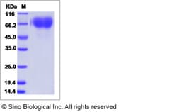 Sino Biological Influenza A H3N2 (A/Switzerland/9715293/2013) Hemagglutinin