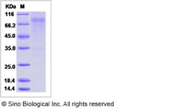 Sino Biological Influenza A H3N2 (A/Switzerland/9715293/2013) Hemagglutinin