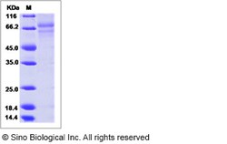 Sino Biological Influenza B (B/PHUKET/3073/2013) Hemagglutinin / HA0 Protein