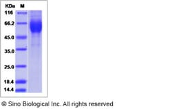 Sino Biological Influenza A H1N1 (A/Fort Monmouth/1/1947) Hemagglutinin