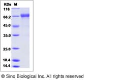 Sino Biological Influenza A H1N1 (A/Memphis/1/1987) Hemagglutinin / HA
