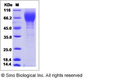 Sino Biological Influenza A H1N1 (A/Memphis/1/1987) Hemagglutinin / HA1