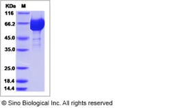 Sino Biological Influenza A H1N1 (A/Mexico/InDRE4114/2009) Hemagglutinin