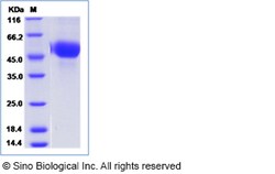 Sino Biological Influenza A H5N8 (A/turkey/Germany-MV/R2472/2014 ) Hemagglutinin
