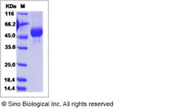 Sino Biological Influenza A H5N2 (A/chicken/Iowa/04-20/2015) Hemagglutinin