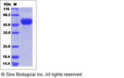 Sino Biological Influenza A H5N8 (A/turkey/California/K1500169-1.2/2015)