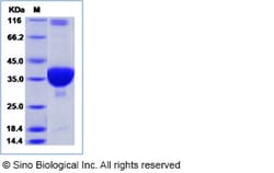 Sino Biological SARS-CoV (strain WH20) Plpro / papain-like protease (His