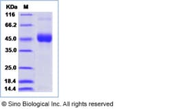Sino Biological Dengue virus (DENV) (type 1, strain US/Hawaii/1944) DENV-NS1